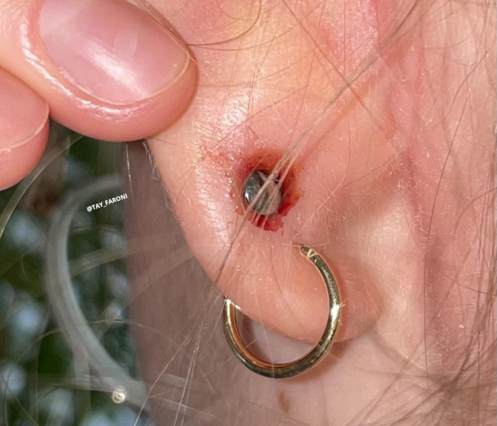 Meu Piercing na Orelha Não Cicatriza Por Quê? As 7 Causas Mais Comuns e Como Resolver Definitivamente
